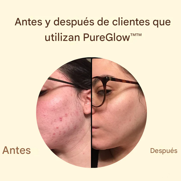 Crema PureGlow - Ultimas unidades