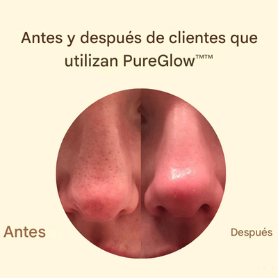 Crema PureGlow - Ultimas unidades